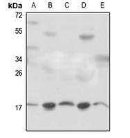 Anti-RPS18 Antibody