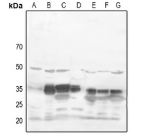 Anti-RRAD Antibody