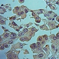 Serpin B4 Rabbit Polyclonal Antibody