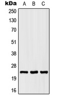 Anti-SCN2B Antibody