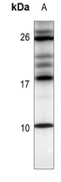 Anti-CXCL12 Antibody