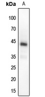Anti-MKK4 (Phospho-T261) Antibody