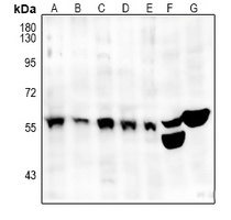 Anti-SRSF4 Antibody