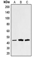 Anti-Alpha-sarcoglycan Antibody