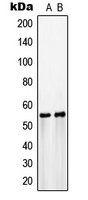 Anti-GLUT3 Antibody