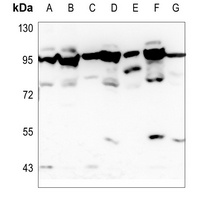 Anti-OATP1 Antibody