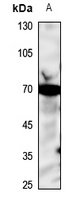 SMPD1 antibody