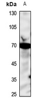 Anti-Acid Sphingomyelinase Antibody