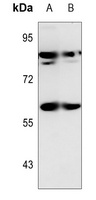 Anti-SNX1 Antibody