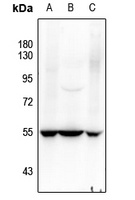 Anti-SOX9 (Phospho-S181) Antibody
