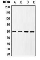 Anti-c-SRC (Phospho-Y419) Antibody