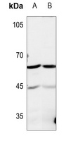 Anti-TROVE2 Antibody