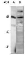 STK11 (phospho-S428) antibody