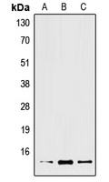 Anti-XCL2 Antibody
