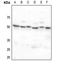 Anti-ADA2A Antibody
