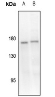 Anti-TIE2 (Phospho-Y1108) Antibody