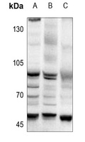 Anti-AP2 alpha/beta Antibody