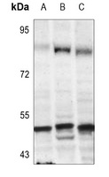 Anti-TFDP1 Antibody