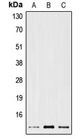 Anti-PS2 Antibody