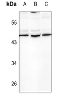 TGFB2 antibody