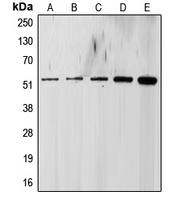 Anti-ALK5 Antibody