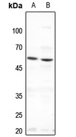 Anti-THRA Antibody