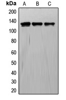 Anti-TIE1 Antibody