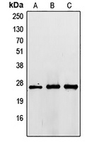 Anti-TIMP3 Antibody