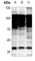 NKX2-1 antibody