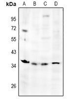 TNFAIP6 antibody