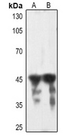 TNNT2 antibody