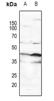 Anti-p53 (Phospho-S15) Antibody