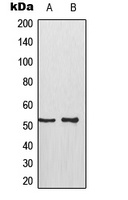 Anti-p53 (Phospho-S315) Antibody