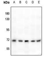 TYR antibody