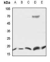 Anti-UBE2D2 Antibody
