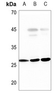 Anti-PGP9.5 Antibody
