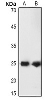 Anti-PGP9.5 Antibody
