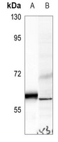 Anti-UGCG Antibody