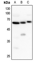 Anti-UGT8 Antibody