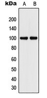 VCAM1 antibody