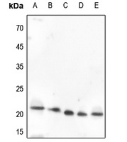 Anti-VEGFB Antibody