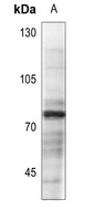 Anti-Vitronectin Antibody