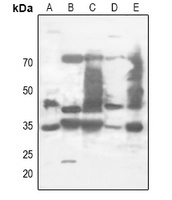 Anti-XPA Antibody