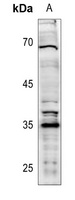 Anti-XRCC2 Antibody