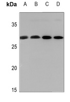 Anti-14-3-3 zeta (Phospho-S58) Antibody