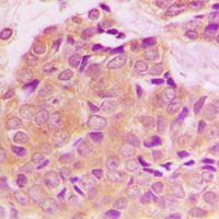 14-3-3 zeta (Phospho-S58) Rabbit Polyclonal Antibody