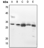Anti-14-3-3 zeta Antibody