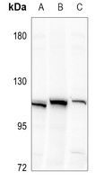 ZNF227 antibody