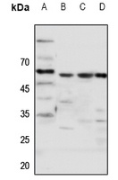 Anti-Frizzled 5 Antibody