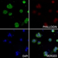 LZTR1 Rabbit Polyclonal Antibody